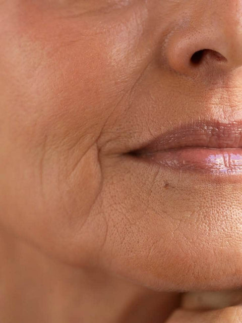 Menopauzában vagyok, megváltozott a bőröm – mit kezdjek ezzel?